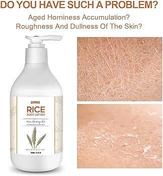 Amazon.com : SURORAIN Rice Moisturizing Skin Lotion 10.1oz- Rice