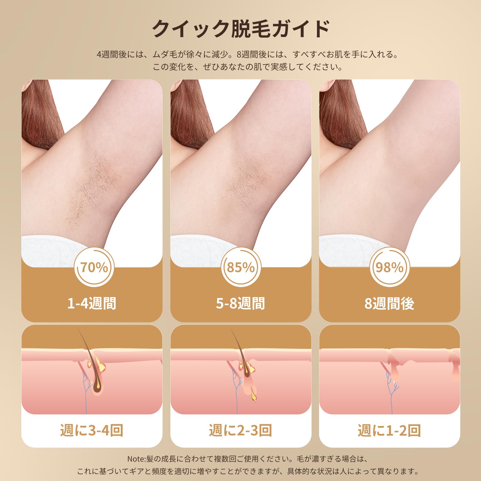 Amazon | YUNDOO脱毛器 レディース メンズ vio対応 【2024最新サロン級