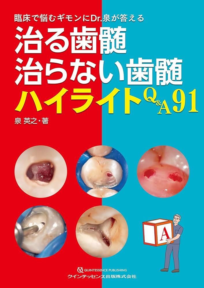 治る歯髄 治らない歯髄 ハイライトQ&A91: 臨床で悩むギモンにDr.泉が