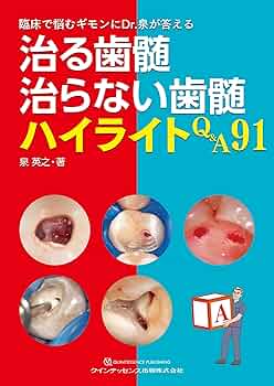 治る歯髄 治らない歯髄 ハイライトQ&A91: 臨床で悩むギモンにDr.泉が
