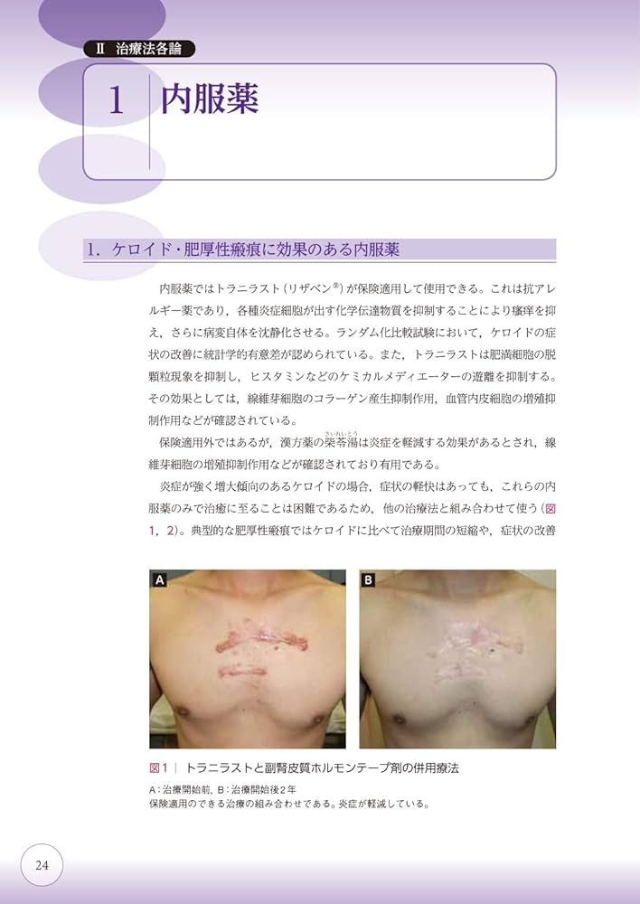 ここまでできる ケロイド・肥厚性瘢痕の予防と治療【電子版付】 | 小川