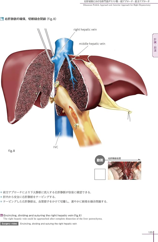 解剖を理解し手術を究める 肝胆膵外科手術 Japanese Mastery in Hepato