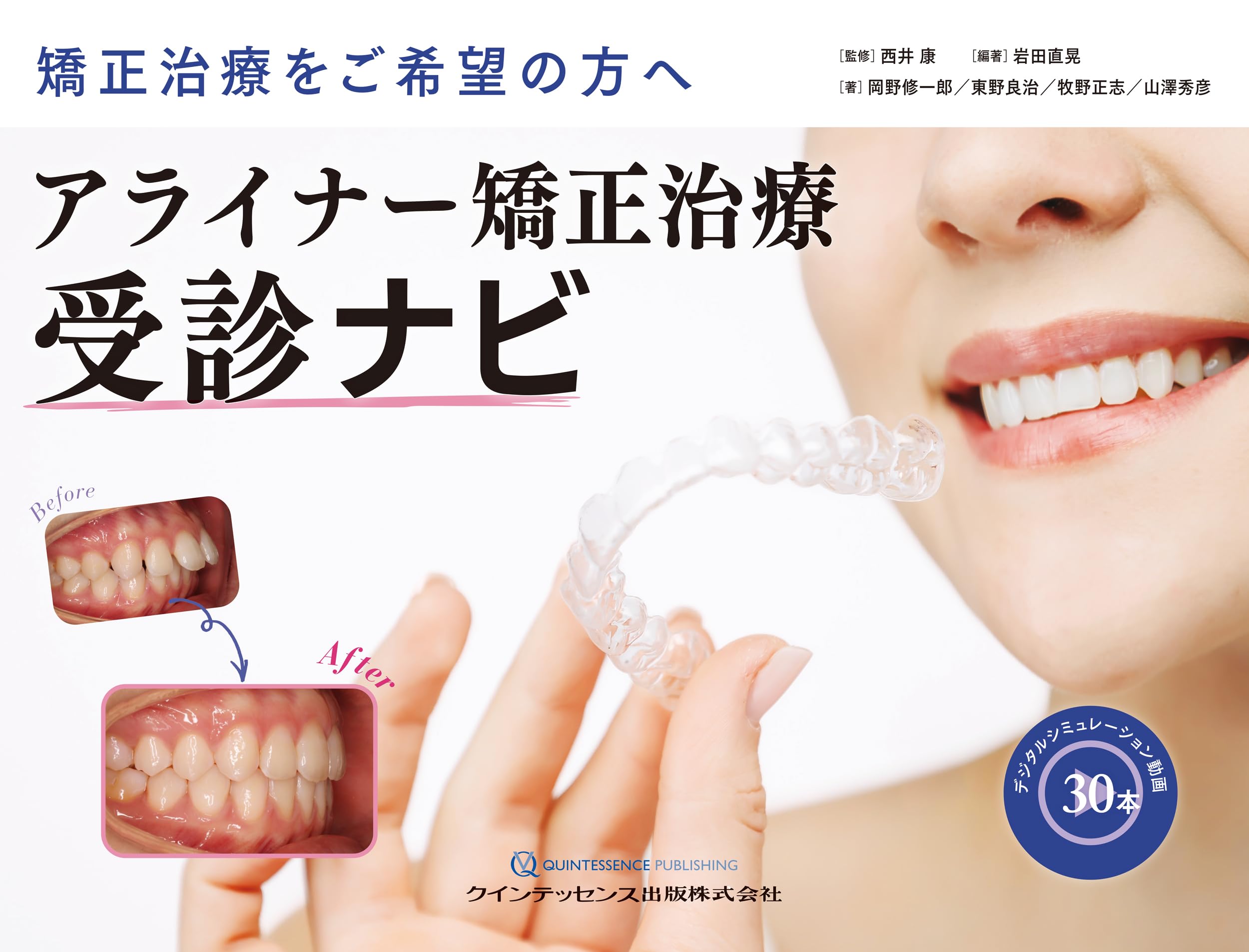 アライナー矯正治療受診ナビ: 矯正治療をご希望の方へ | 西井 康, 岩田