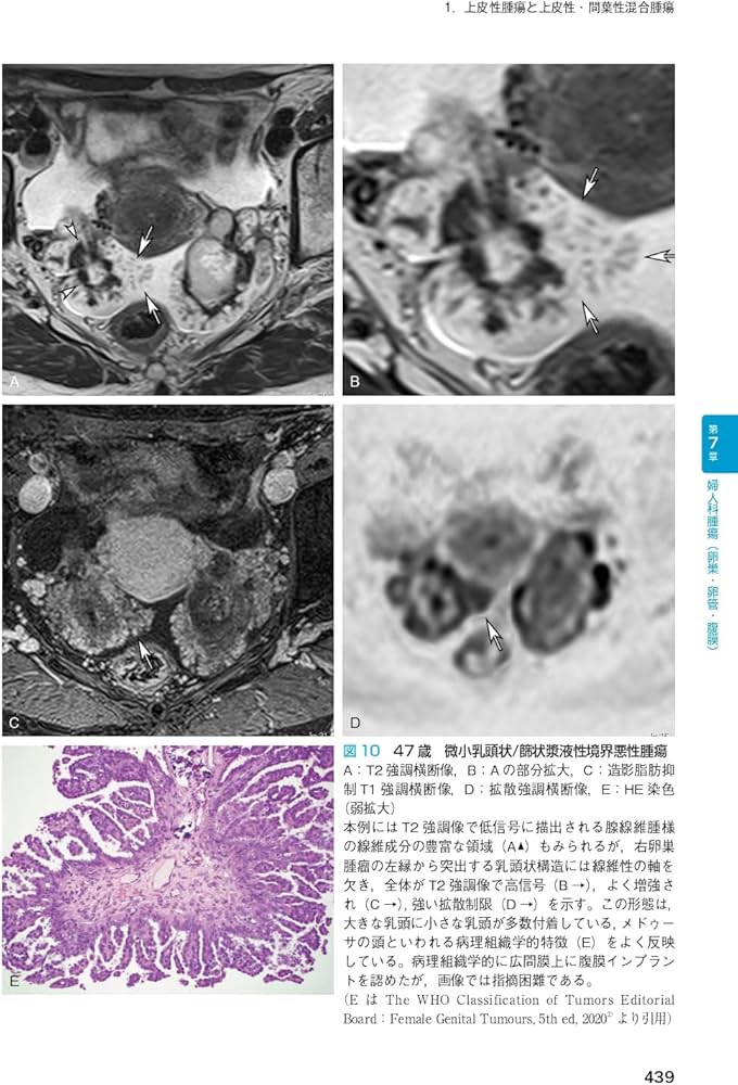 産婦人科の画像診断 第2版 | 田中 優美子 |本 | 通販 | Amazon
