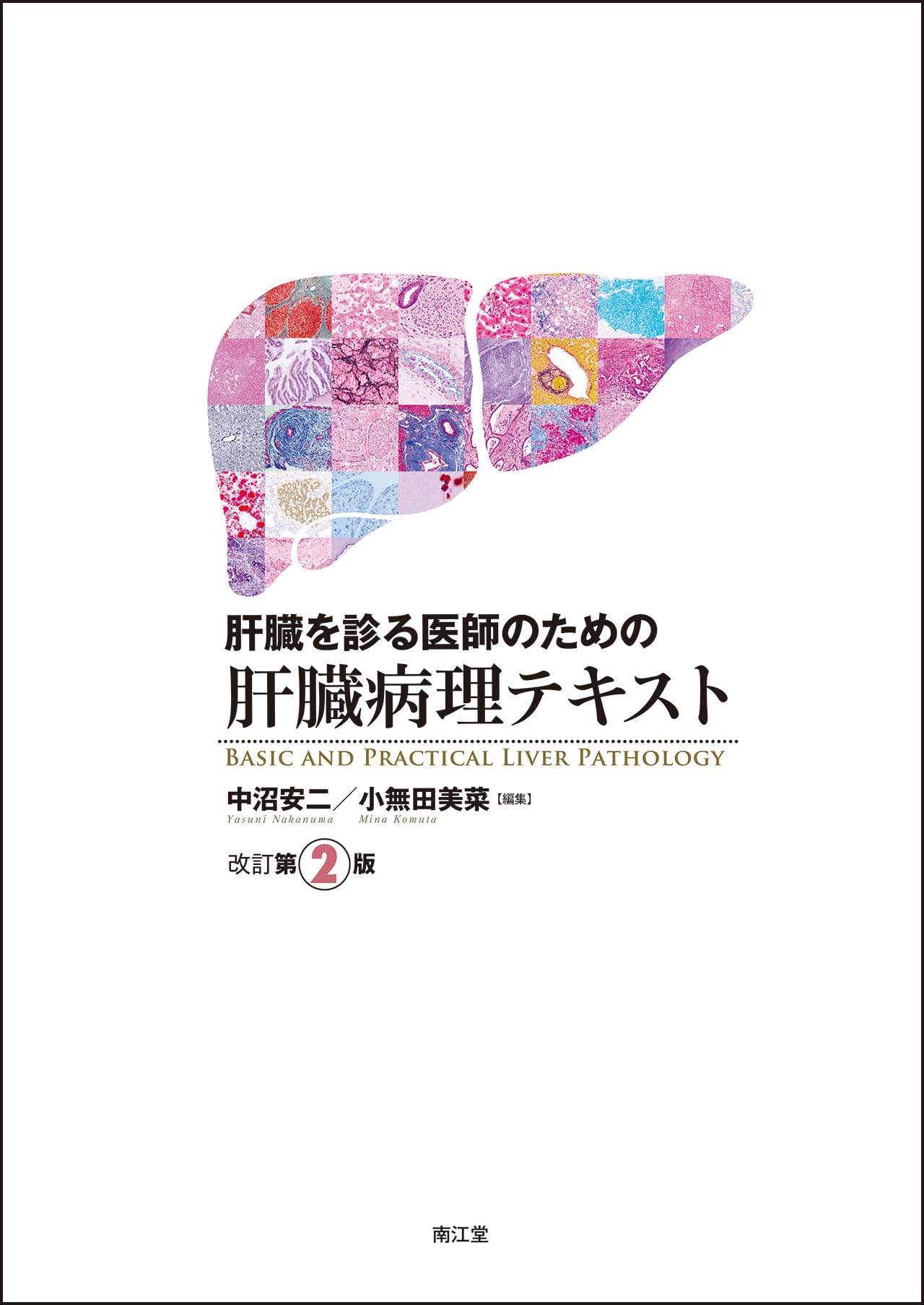 肝臓を診る医師のための肝臓病理テキスト(改訂第2版) | 中沼安二