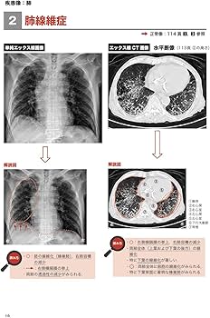 理学療法士・作業療法士 PT・OT基礎から学ぶ画像の読み方第4版 国試