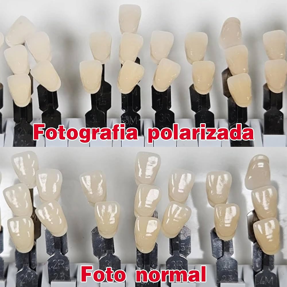 Amazon.com : Cross-Polarization Sets for Flashes - Dental
