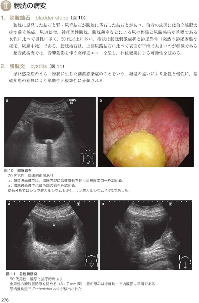 日超検 腹部超音波テキスト第3版 | 日本超音波検査学会, 南里 和秀