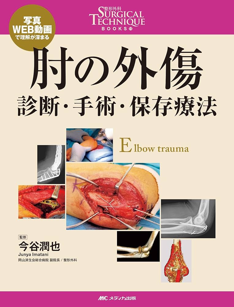 Amazon.co.jp: 肘の外傷:診断・手術・保存療法 (整形外科SURGICAL