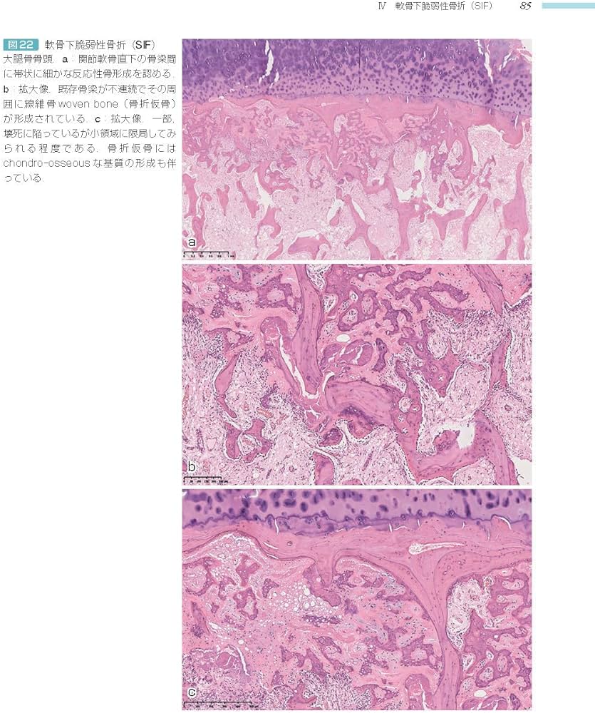 71qu0MRqoeL._AC_UF1000,