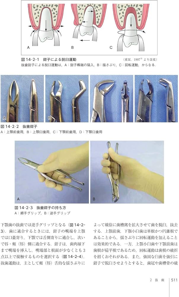 口腔外科学 第4版 | 白砂 兼光, 古郷 幹彦 |本 | 通販 | Amazon