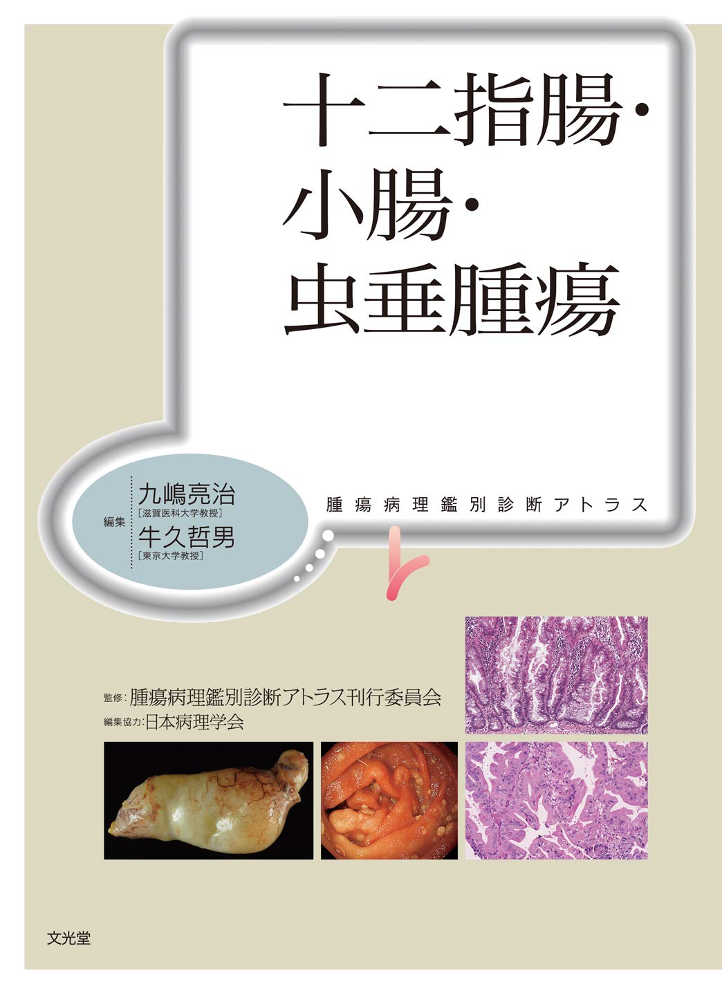 十二指腸・小腸・虫垂腫瘍 (腫瘍病理鑑別診断アトラス) | 九嶋亮治