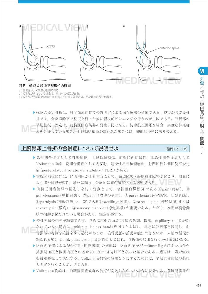 Amazon.co.jp: 整形外科専門医へのminimal requirements : 山崎 正志