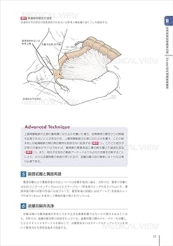 尿路変向・再建術 (Urologic Surgery Next 5) | 荒井 陽一 |本 | 通販