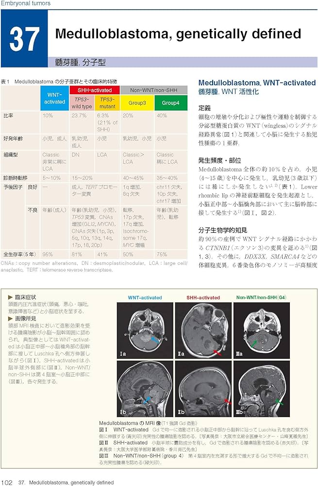 Amazon.co.jp: 脳腫瘍臨床病理カラーアトラス 第4版 : 日本脳腫瘍病理