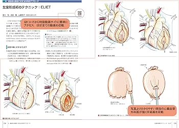 冠動脈疾患の手術 (心臓血管外科手術エクセレンス) | 夜久 均, 高梨