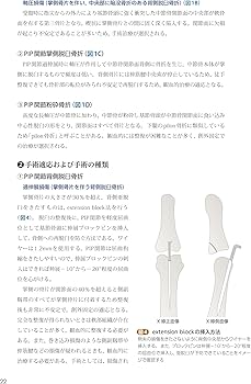 手外科手術ノート part2：代表的な骨折・外傷編 | 大井宏之 |本 | 通販