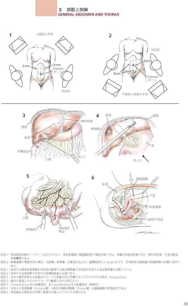 ゾリンジャー外科手術アトラス 第2版 | 安達 洋祐 |本 | 通販 | Amazon