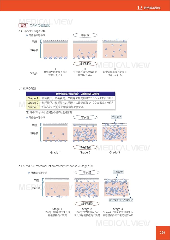 基礎と臨床の両側面からみた 胎盤学 | 日本胎盤学会 |本 | 通販 | Amazon