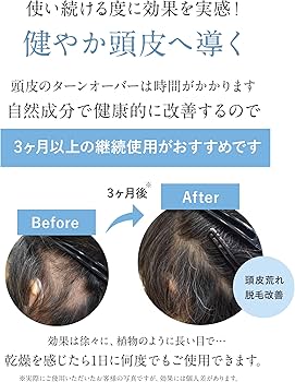 Amazon.co.jp: ここラボ ここラボスカルプセラム詰替用 (100ml×1袋