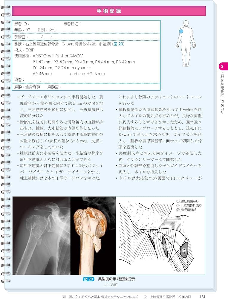 骨折治療基本手技アトラス~押さえておきたい10のプロジェクト | 最上