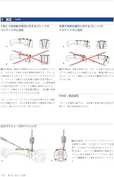 818kmo5l-TL._AC_UF350,