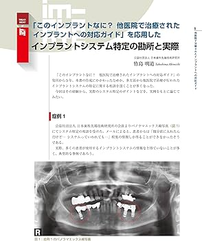 続・このインプラントなに? 他医院で治療されたインプラントへの対応