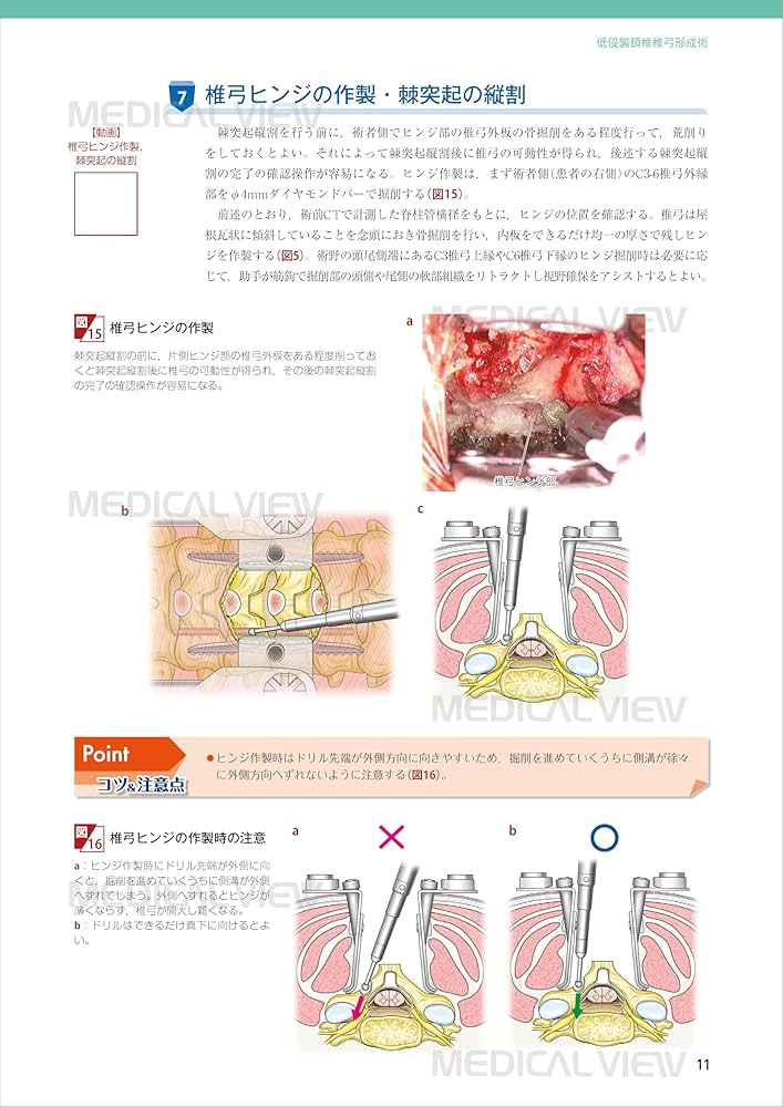 最小侵襲脊椎外科［Web動画付］ (新OS NEXUS No.11) | 佐藤 公治 |本