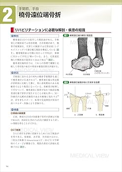運動器疾患の治療とリハビリテーション−手術・保存療法とリハ
