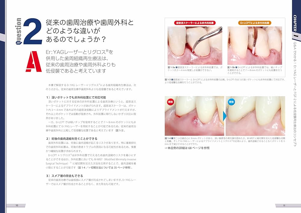 Amazon.co.jp: Er:YAGレーザーとFGF-2による低侵襲再生療法 : 原田