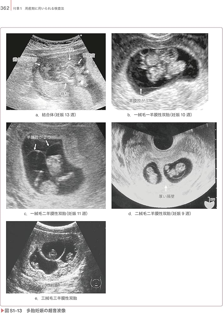 助産診断・技術学II 第6版: [1]妊娠期 (助産学講座) | 我部山 キヨ子