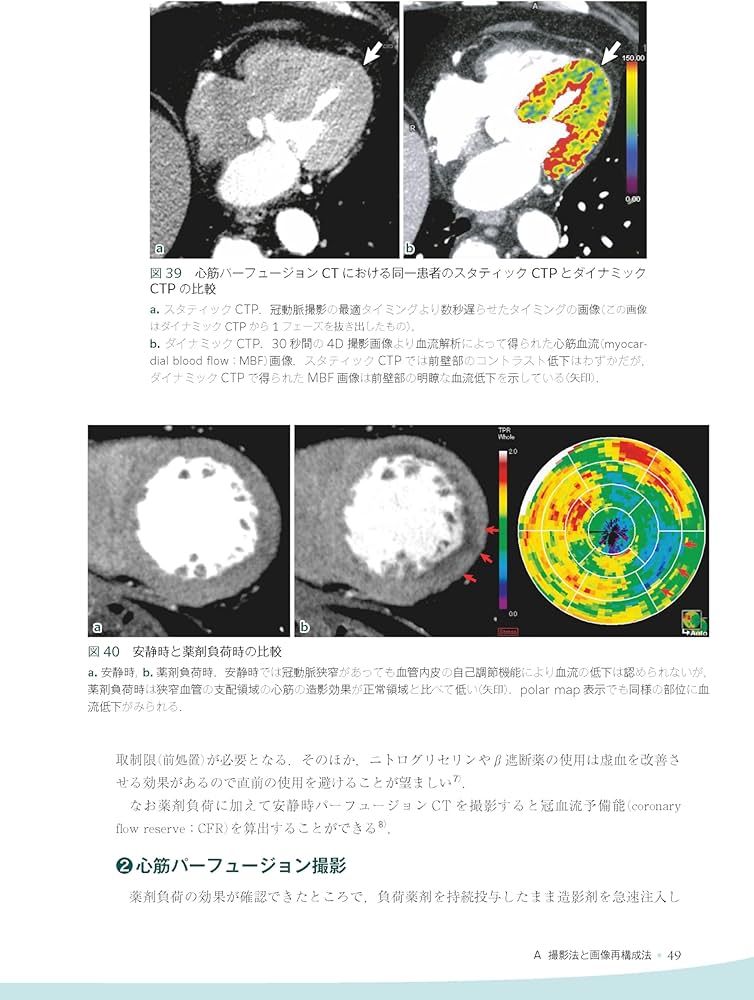 心臓疾患のCTとMRI 第2版 | 佐久間肇, 陣崎雅弘, 北川覚也, 石田正樹