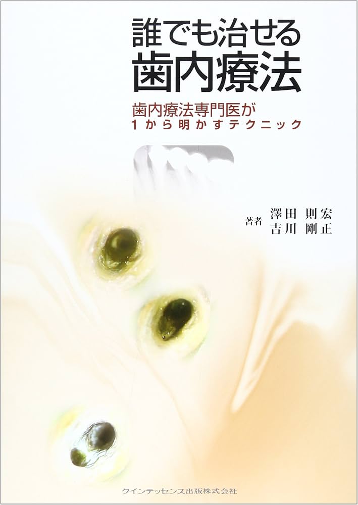 誰でも治せる歯内療法 | 澤田 則宏, 吉川 剛正 |本 | 通販 | Amazon
