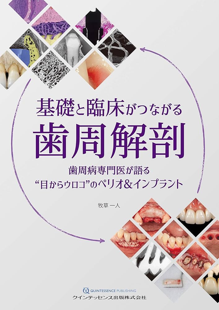 基礎と臨床がつながる歯周解剖 | 牧草 一人 |本 | 通販 | Amazon