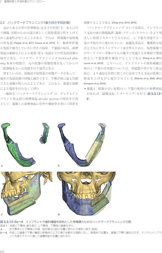 AO法骨折治療 アドバンスト頭蓋顎顔面手術: 腫瘍、骨矯正、外傷 | 下郷