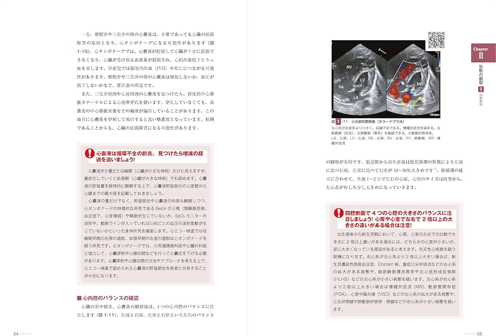 Amazon.co.jp: 改訂2版 新生児の心エコー入門:超音波検査にもとづく