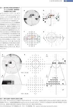 これさえ学べば死角なし!視野フロンティア (新篇眼科プラクティス 13
