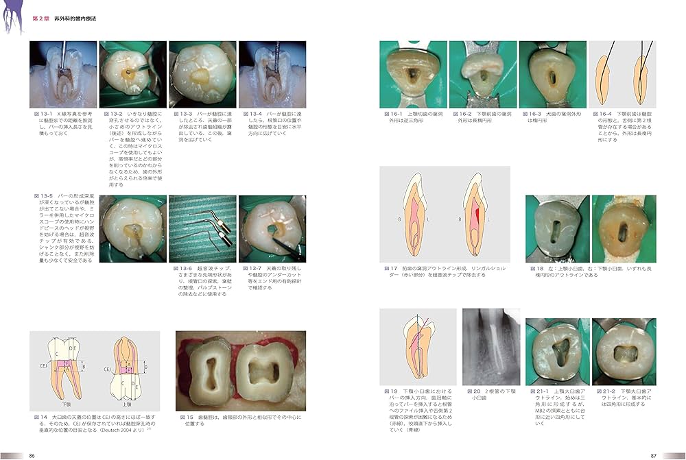 世界基準の臨床歯内療法 | 石井 宏 |本 | 通販 | Amazon