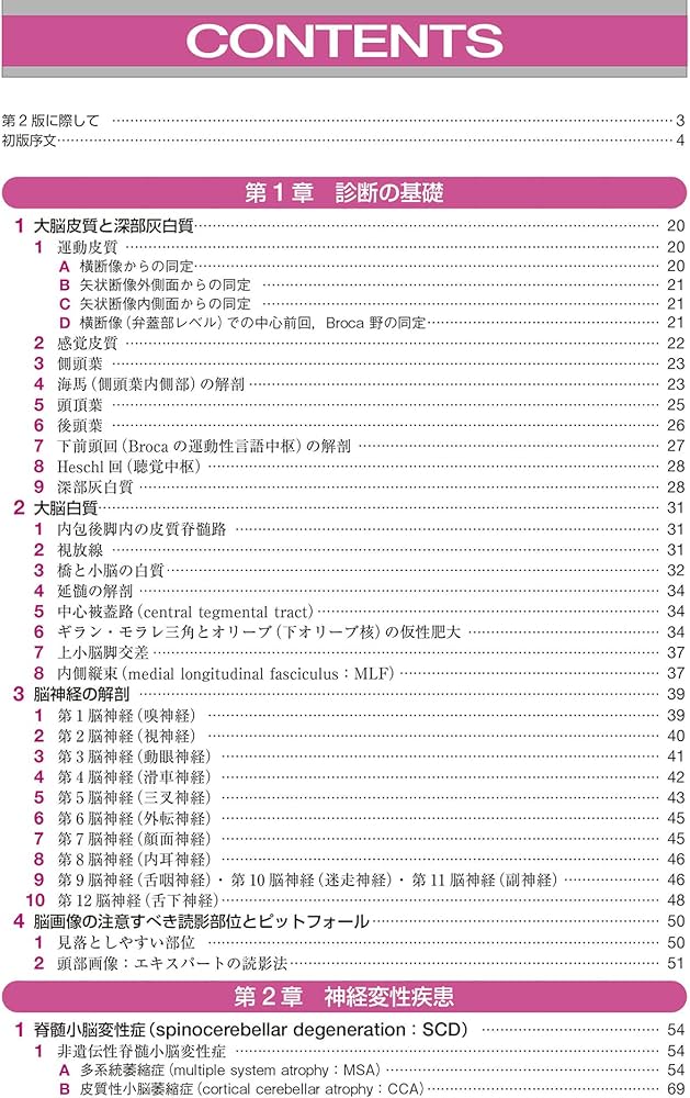 神経内科疾患の画像診断 第2版 | 柳下 章 |本 | 通販 | Amazon
