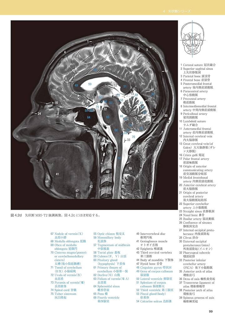 脳の機能解剖と画像診断 第2版 | 眞柳 佳昭 |本 | 通販 | Amazon