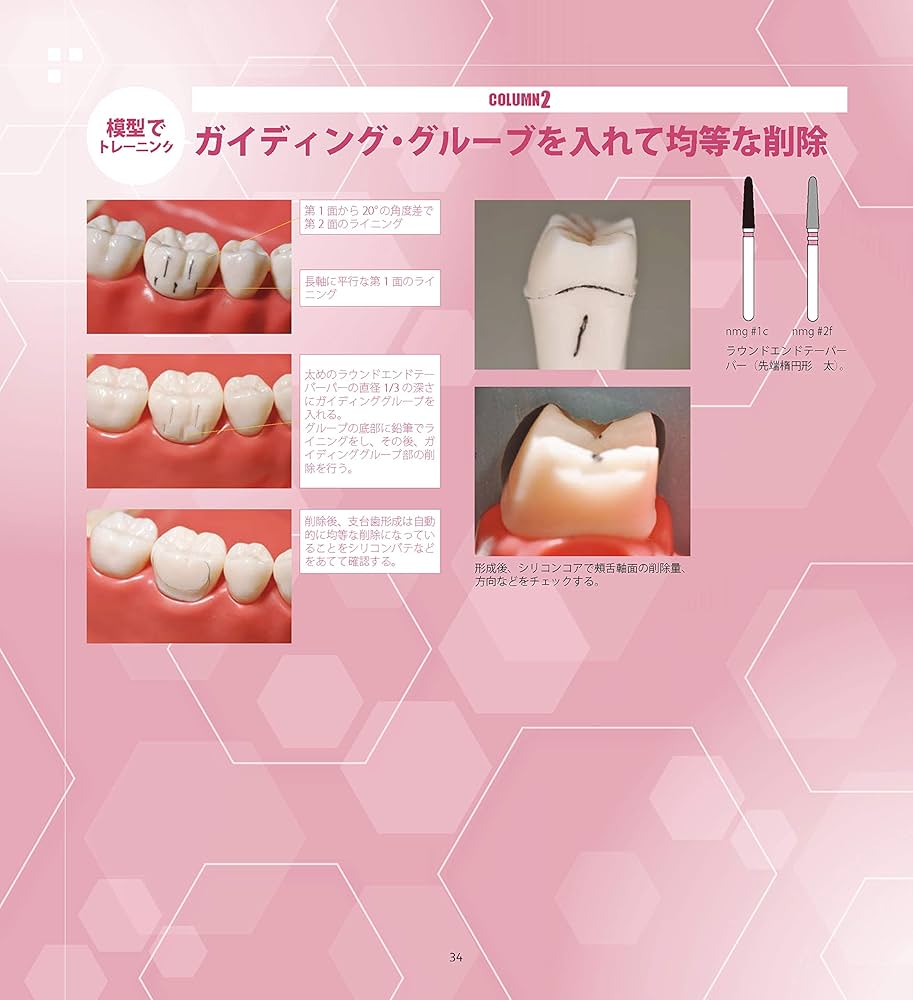 VISUAL支台歯形成-臼歯部編 (Clinical Tooth Preparation) | 西川 義昌