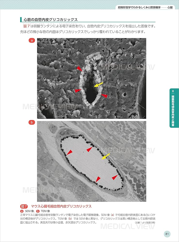 New Strategy! 超微形態生理学 ICU輸液がみえるグリコカリックス