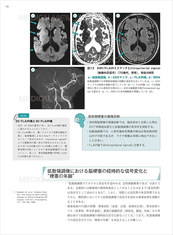 頭部 画像診断の勘ドコロNEO | 田岡 俊昭 |本 | 通販 | Amazon