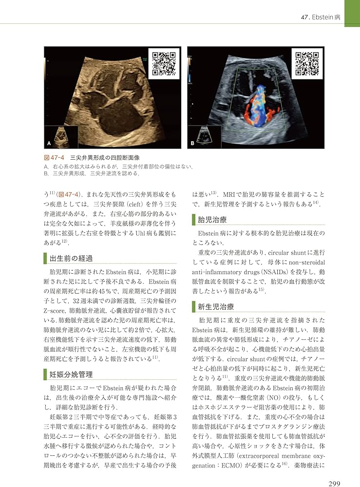 周産期マニュアル: 胎児疾患の診断から管理まで | 佐村 修, 宗田 聡