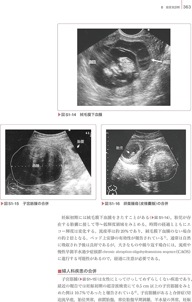 81KA8ThE1uS._AC_UF1000,