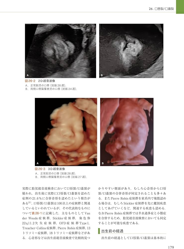周産期マニュアル: 胎児疾患の診断から管理まで | 佐村 修, 宗田 聡