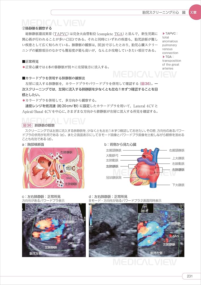 81LXm02lUOL._AC_UF1000,