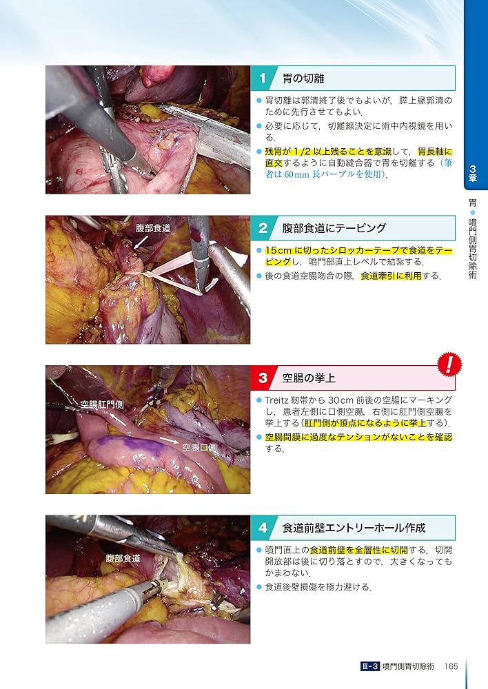 内視鏡外科消化器再建術のすべて | 阿部展次, 上野正紀, 江原一尚