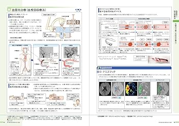 病気がみえる vol.7 脳・神経 第2版 | 医療情報科学研究所 |本 | 通販