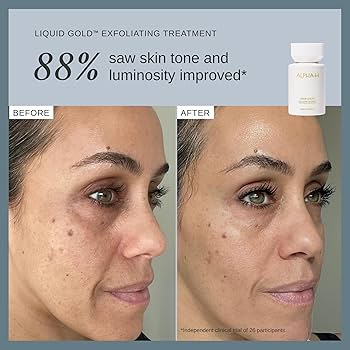 Amazon.com: Alpha-H Liquid Gold Exfoliating Treatment 5% Glycolic